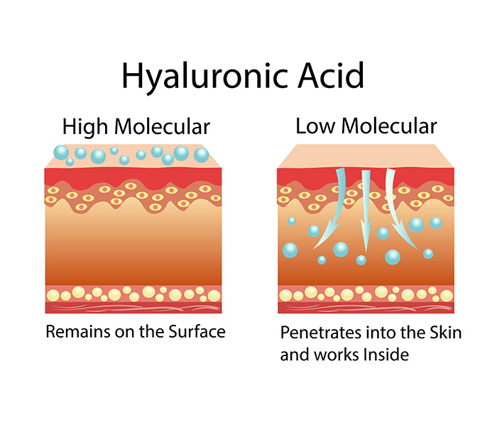 Hyaluronic Acid